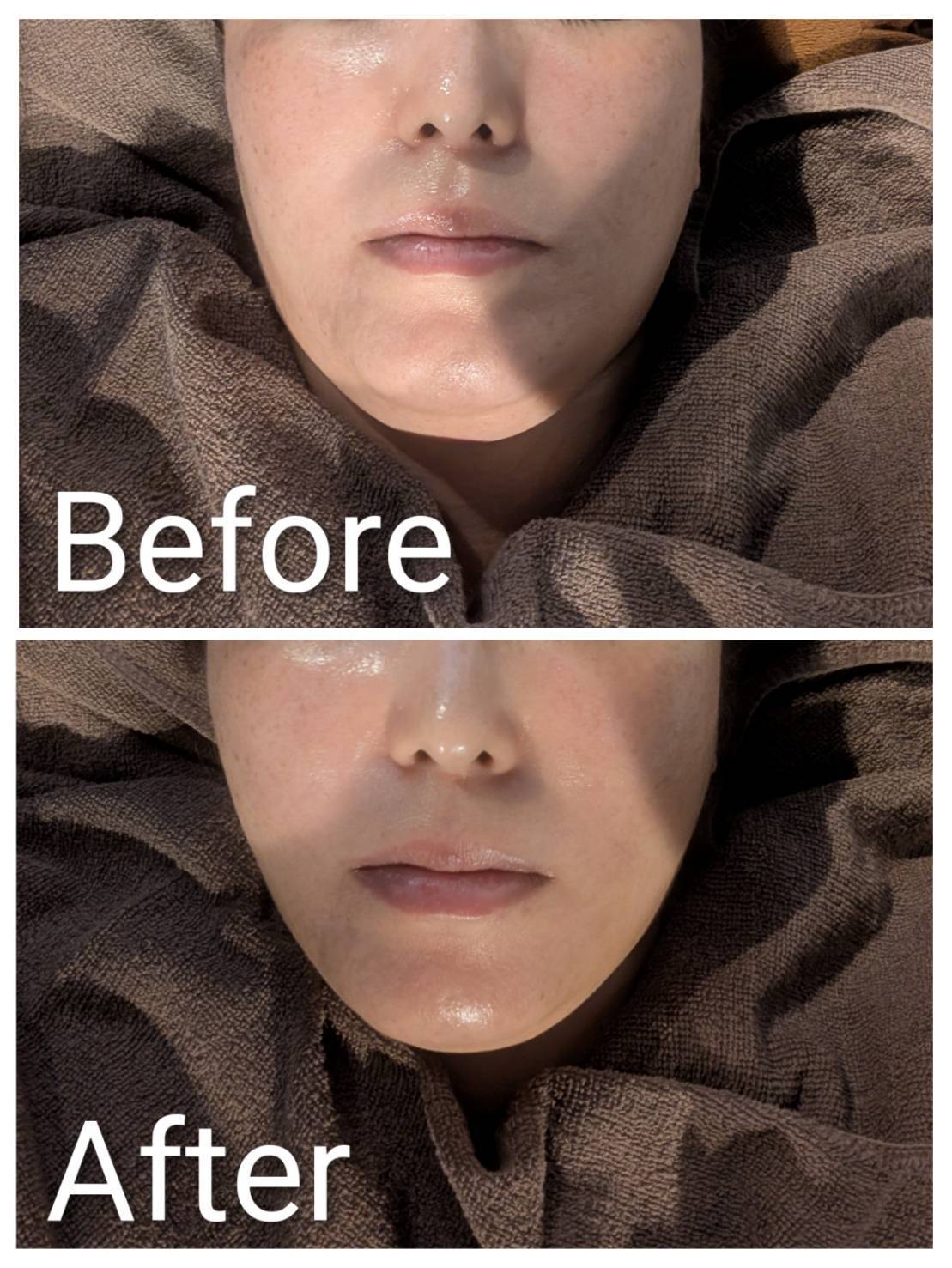 フェイシャル施術イメージ1