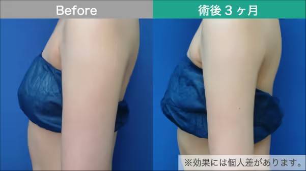 フェイシャル施術イメージ1