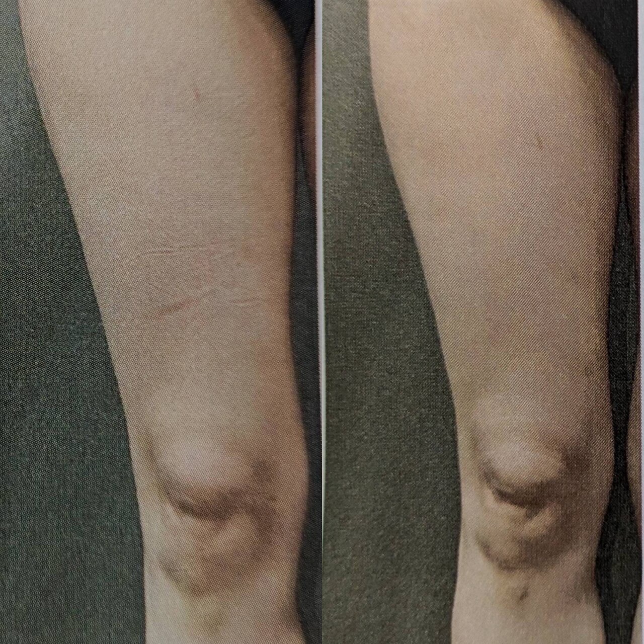 フェイシャル施術イメージ2